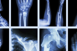  Orthopaedics Department